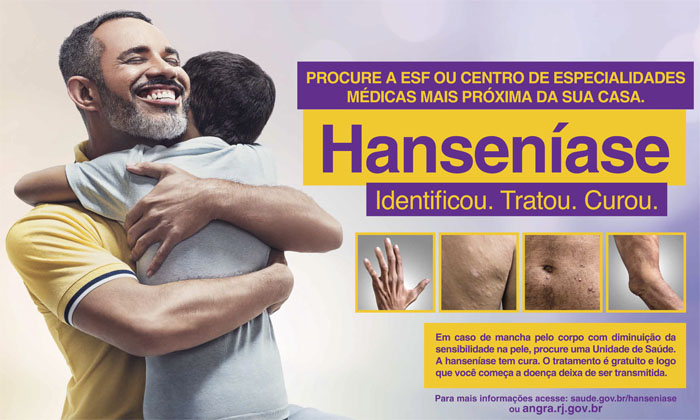 Capa da notícia: Exames gratuitos de hanseníase  