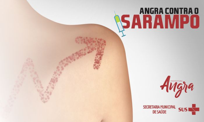 Capa da notícia: Angra contra o sarampo