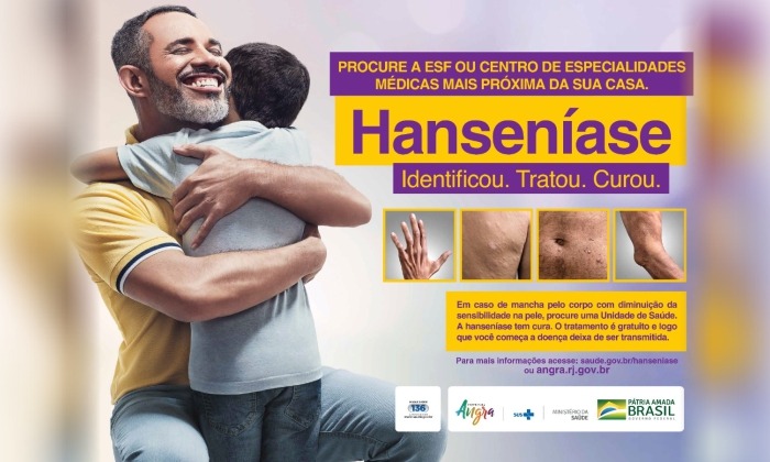 Capa da notícia: Campanha contra a Hanseníase investe em informação